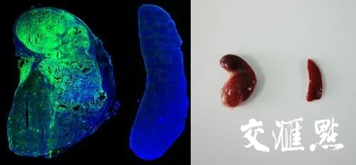 转化后的脾脏与正常脾脏的组织学分析和外观照片（左：转化后的脾脏；右：正常脾脏）